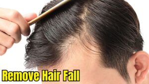 How To Remove Hair Fall And Dandruff, See Effective Remedies And Tips