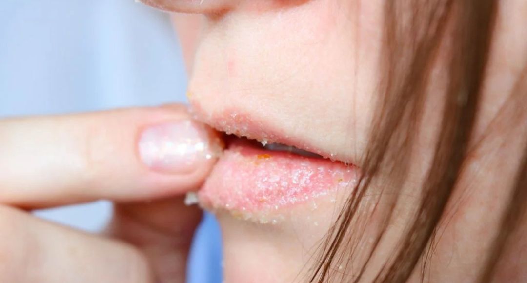 Lips